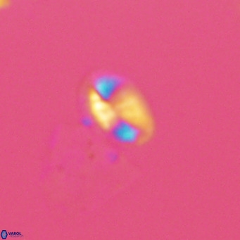 Helicosphaera hyalina VR 04999