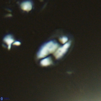 Helicosphaera hyalina VR 04187