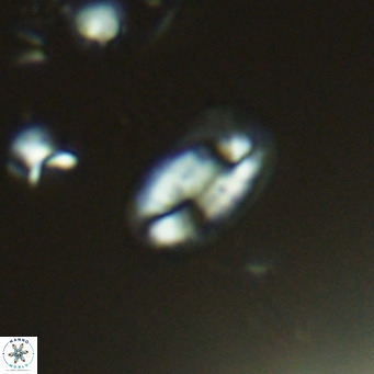 Helicosphaera hyalina VR 04187