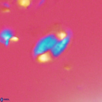 Helicosphaera hyalina VR 04188