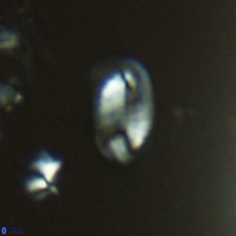 Helicosphaera hyalina VR 04189