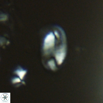 Helicosphaera hyalina VR 04189