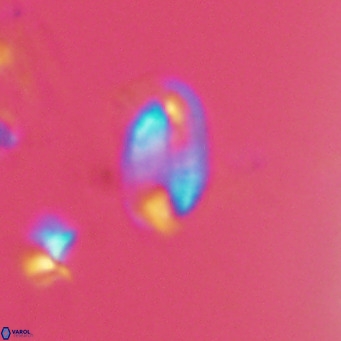 Helicosphaera hyalina VR 04190