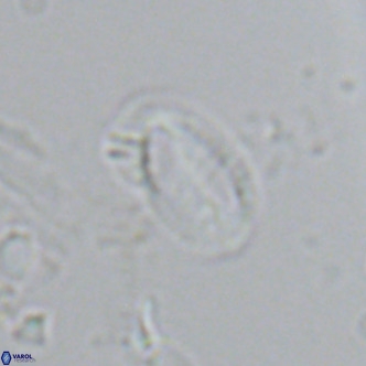 Helicosphaera hyalina VR 04195