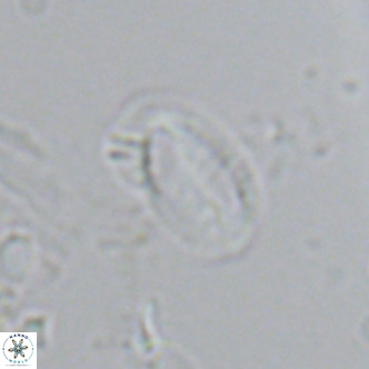 Helicosphaera hyalina VR 04195