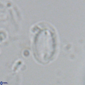 Helicosphaera hyalina VR 04197