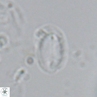 Helicosphaera hyalina VR 04197