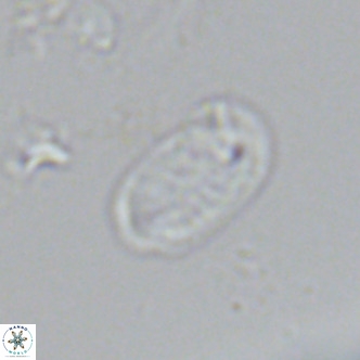 Helicosphaera hyalina VR 04198