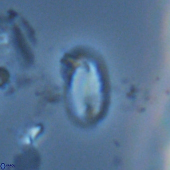 Helicosphaera hyalina VR 04201