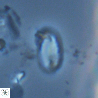 Helicosphaera hyalina VR 04201