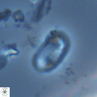 Helicosphaera hyalina VR 04202