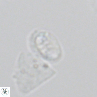 Helicosphaera hyalina VR 05000