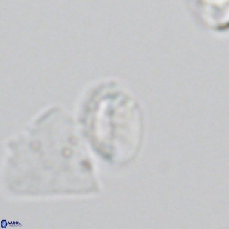 Helicosphaera hyalina VR 05001