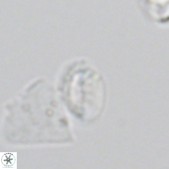 Helicosphaera hyalina VR 05001