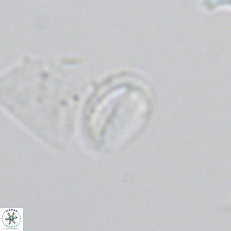 Helicosphaera hyalina VR 05003