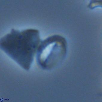 Helicosphaera hyalina VR 05004