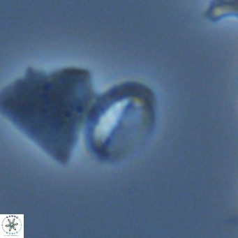 Helicosphaera hyalina VR 05004