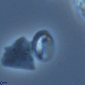 Helicosphaera hyalina VR 05005