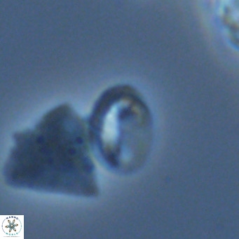 Helicosphaera hyalina VR 05005