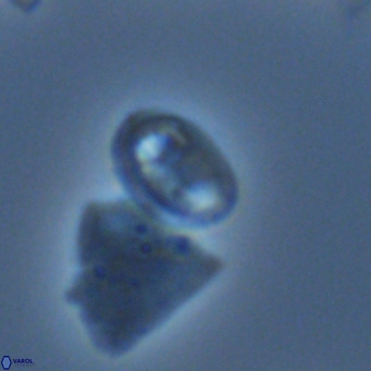 Helicosphaera hyalina VR 05006