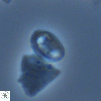 Helicosphaera hyalina VR 05006
