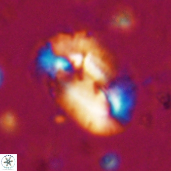 Helicosphaera incisura 19719