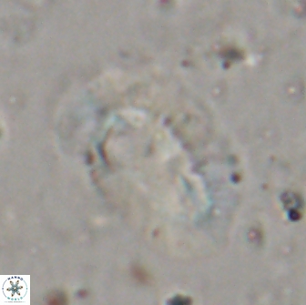 Helicosphaera incisura 19720