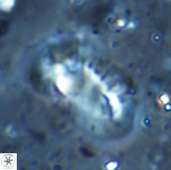 Helicosphaera incisura 19721