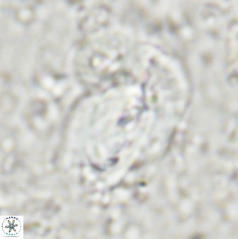 Helicosphaera incisura 48902