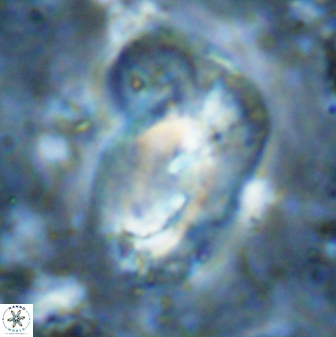 Helicosphaera incisura 48903