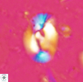 Helicosphaera inermedia 29875