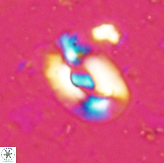 Helicosphaera inermedia 29877