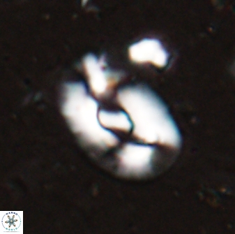 Helicosphaera inermedia 29878