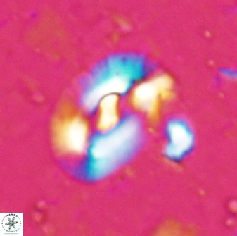 Helicosphaera inermedia 29879