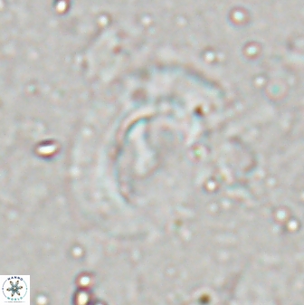 Helicosphaera inermedia 29881