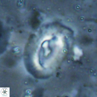 Helicosphaera inermedia 29882