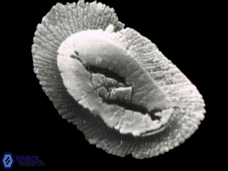 Helicosphaera intermedia 1075 3