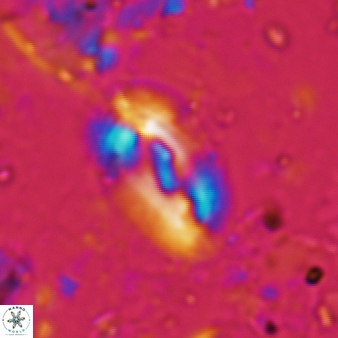 Helicosphaera intermedia 474