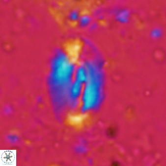 Helicosphaera intermedia 475