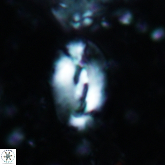 Helicosphaera intermedia 476
