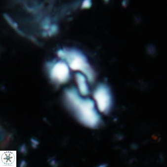 Helicosphaera intermedia 473
