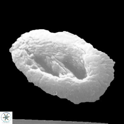 Helicosphaera intermedia 948 12