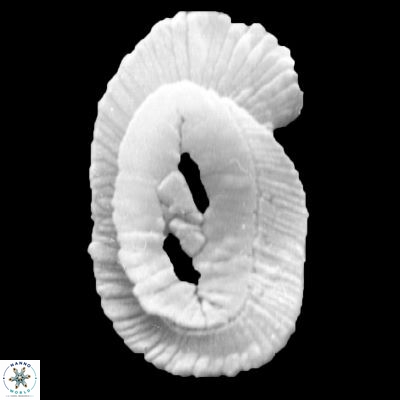 Helicosphaera intermedia 943 4