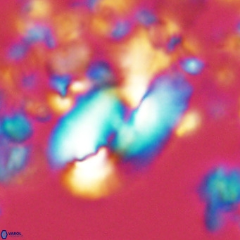 Helicosphaera kamptneri VR 05495