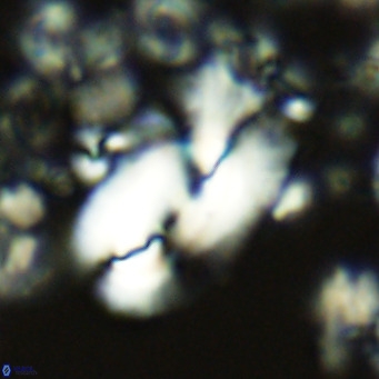 Helicosphaera kamptneri VR 05496