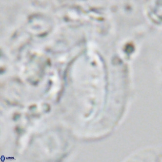 Helicosphaera kamptneri VR 05503