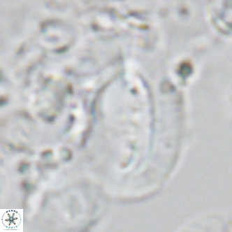 Helicosphaera kamptneri VR 05503