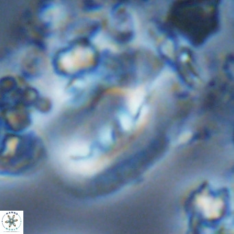 Helicosphaera kamptneri VR 05507