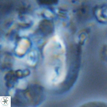 Helicosphaera kamptneri VR 05508