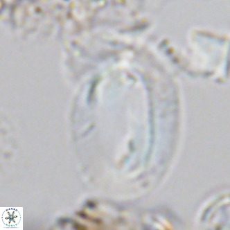 Helicosphaera kamptneri VR 05652